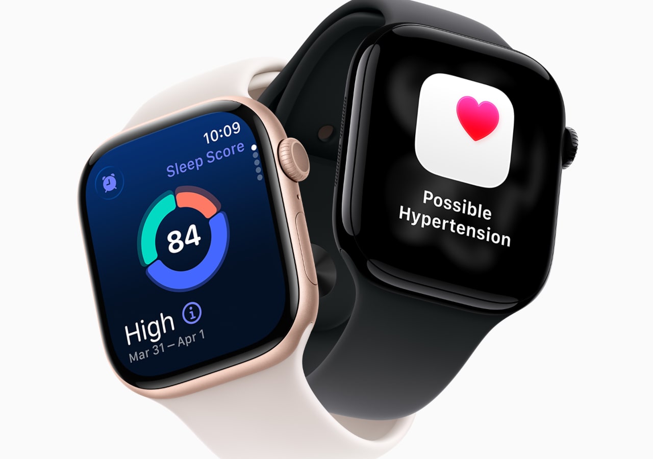 Deux montres intelligentes affichant santé et sommeil. apple watch series 11